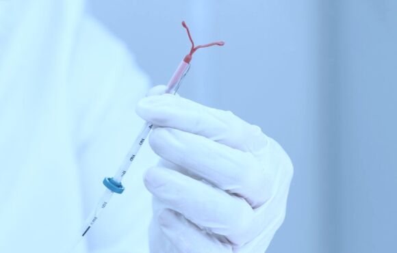 Inserimento IUD